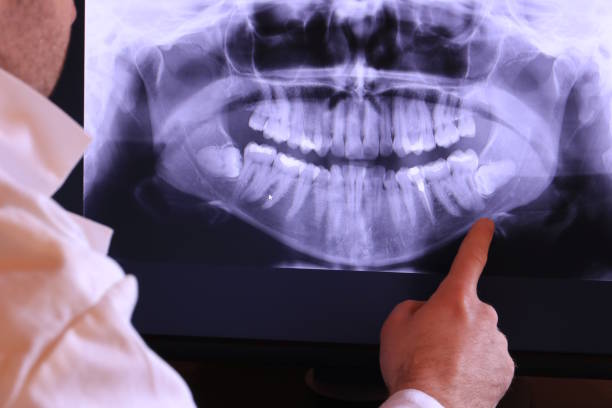 Best Walk-In Emergency Dentist in Shandon, CA