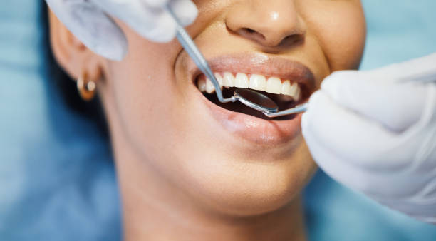 Best Emergency Wisdom Teeth Removal in Shandon, CA