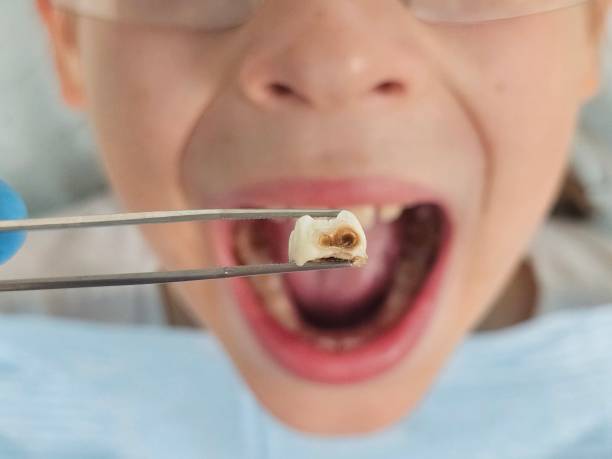 Best Emergency Treatment for Toothache in Shandon, CA