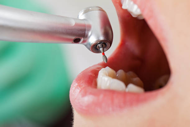 Best Emergency Dental Care for Trauma or Injury in Shandon, CA